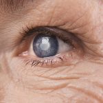 segmento anterior